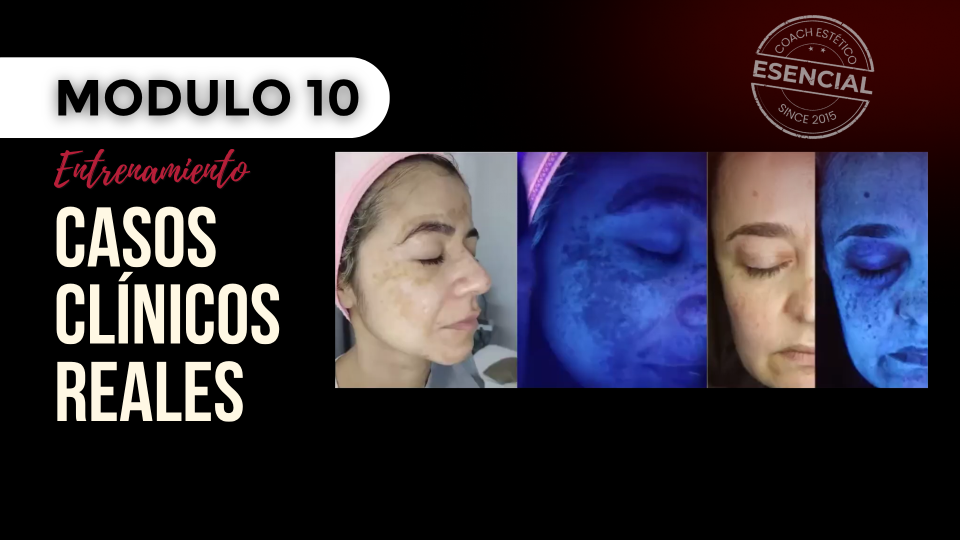Módulo 10 — Casos clínicos reales
