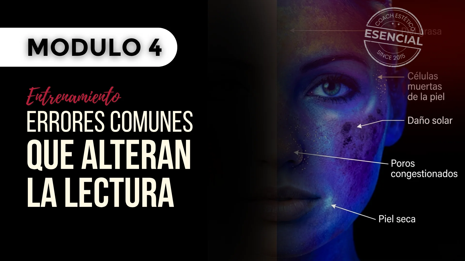Módulo 04 — Errores comunes que alteran la lectura