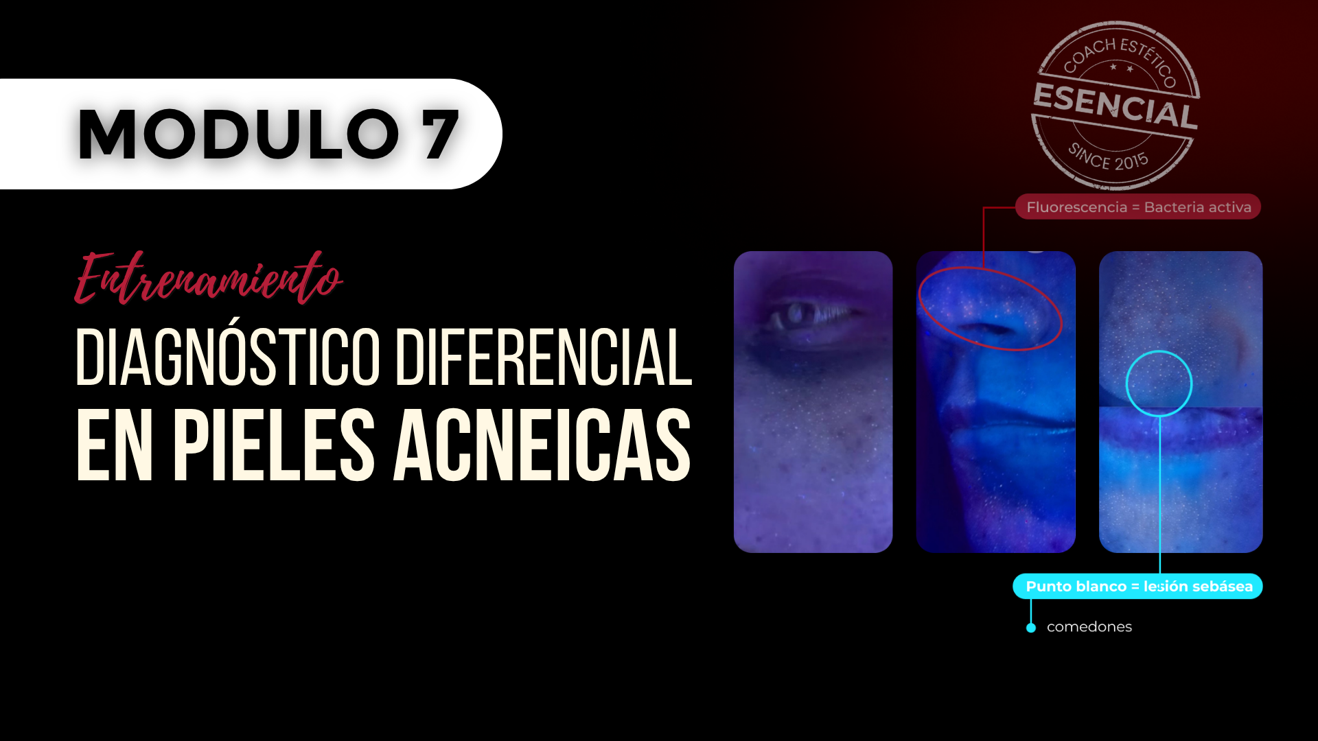 Módulo 07 — Diagnóstico diferencial en pieles acneicas