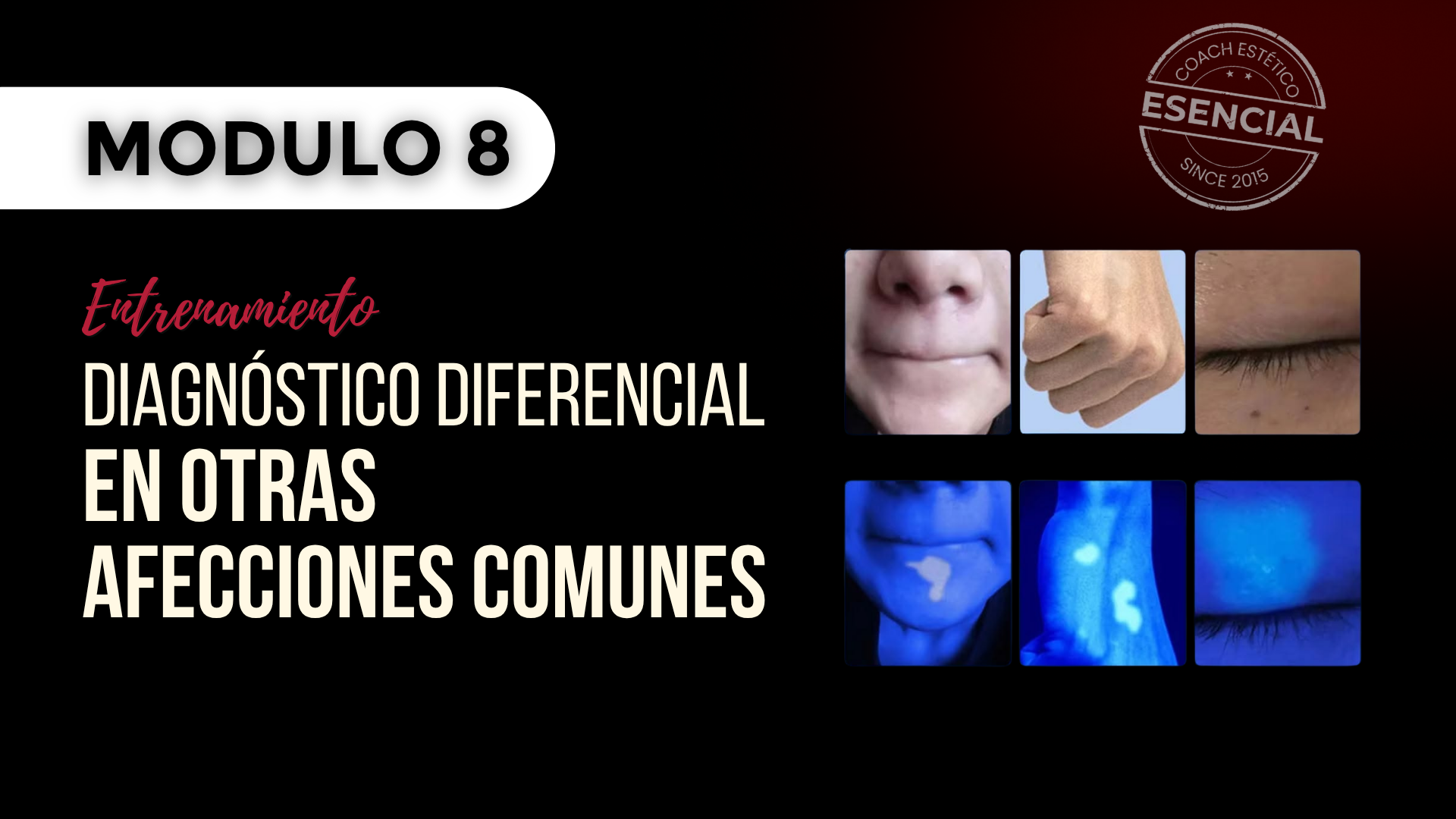 Módulo 08 — Diagnóstico diferencial en otras afecciones comunes