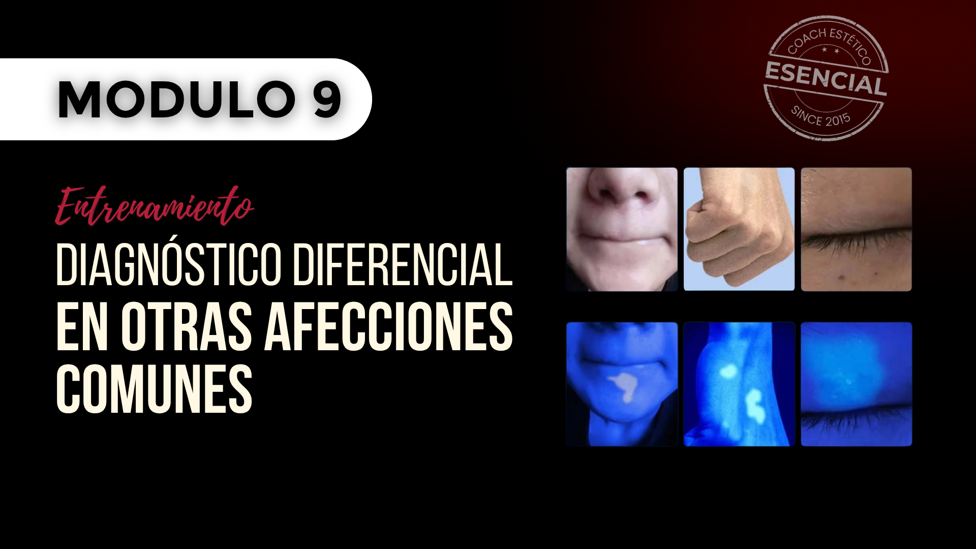 Módulo 09 — Diagnóstico diferencial en otras afecciones